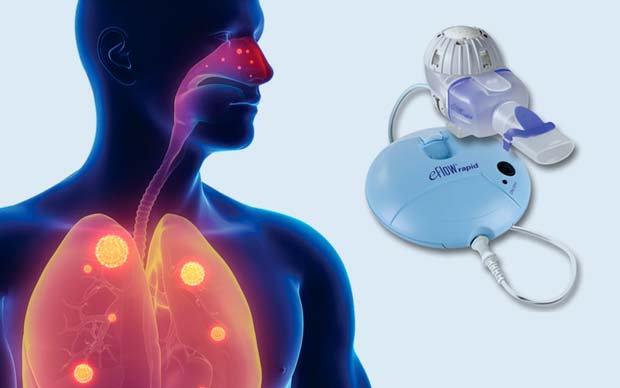 Beneficio de los nebulizadores para la salud -canalSALUD